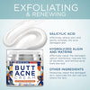 Image of BellamiLuxx Butt & Thigh Acne Clearing Cream - Moisturizing & Exfoliating 1.7 Fl Oz for Acne Prone Skin
